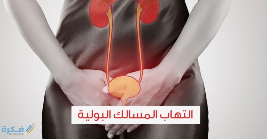 علاج التهاب المثانة بالطب النبوي 1 IMG ٢٠٢٠٠٥١٧ ١٤١٩٤٩