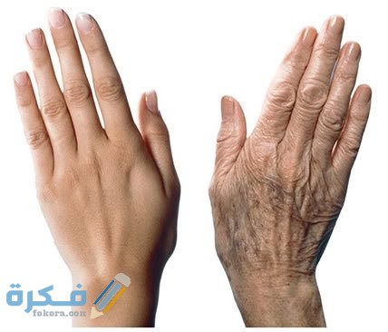 3 أسباب ظهور عروق اليدين تعرف عليهم 1 IMG 20200605 WA0030