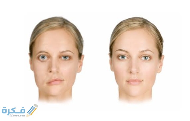 اعراض التهاب العصب السابع بالوجع البسيط وعلاجه 1 IMG ٢٠٢٠٠٨١٢ ١١٤٨٤٤