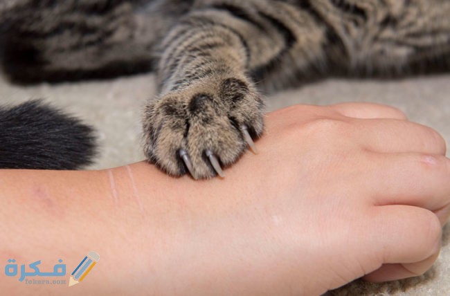 خربشة القطة وعلاجها 1 42011 catScratch YKL 092920 770x553 1 650x428 1