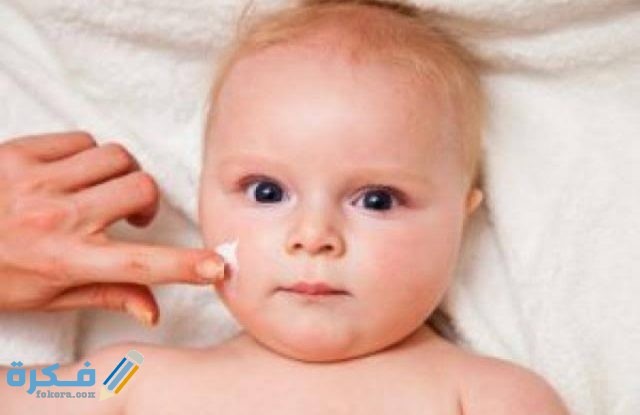 بقع بيضاء في الوجه عند الأطفال الرضع أسبابها وطرق علاجها