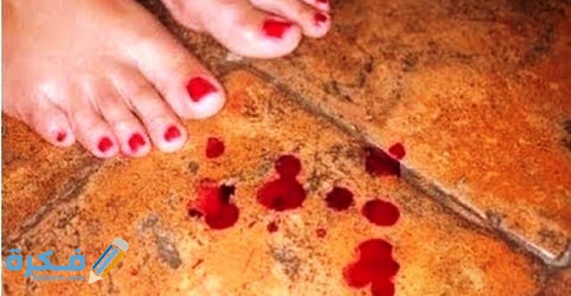 طرق علاج النزيف الحاد