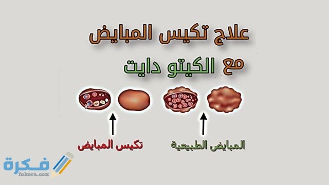 فوائد واعراض نظام كيتو الغذائي 