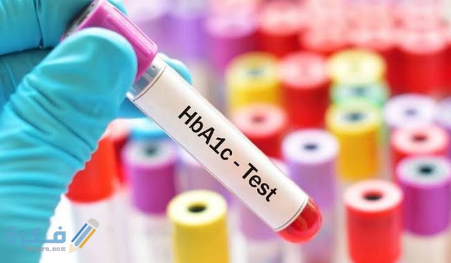ما هو تحليل hba1c الهيموجلوبين السكري وشرح خطوات قراءة التحليل 1 images 2021 05 28T233639.863