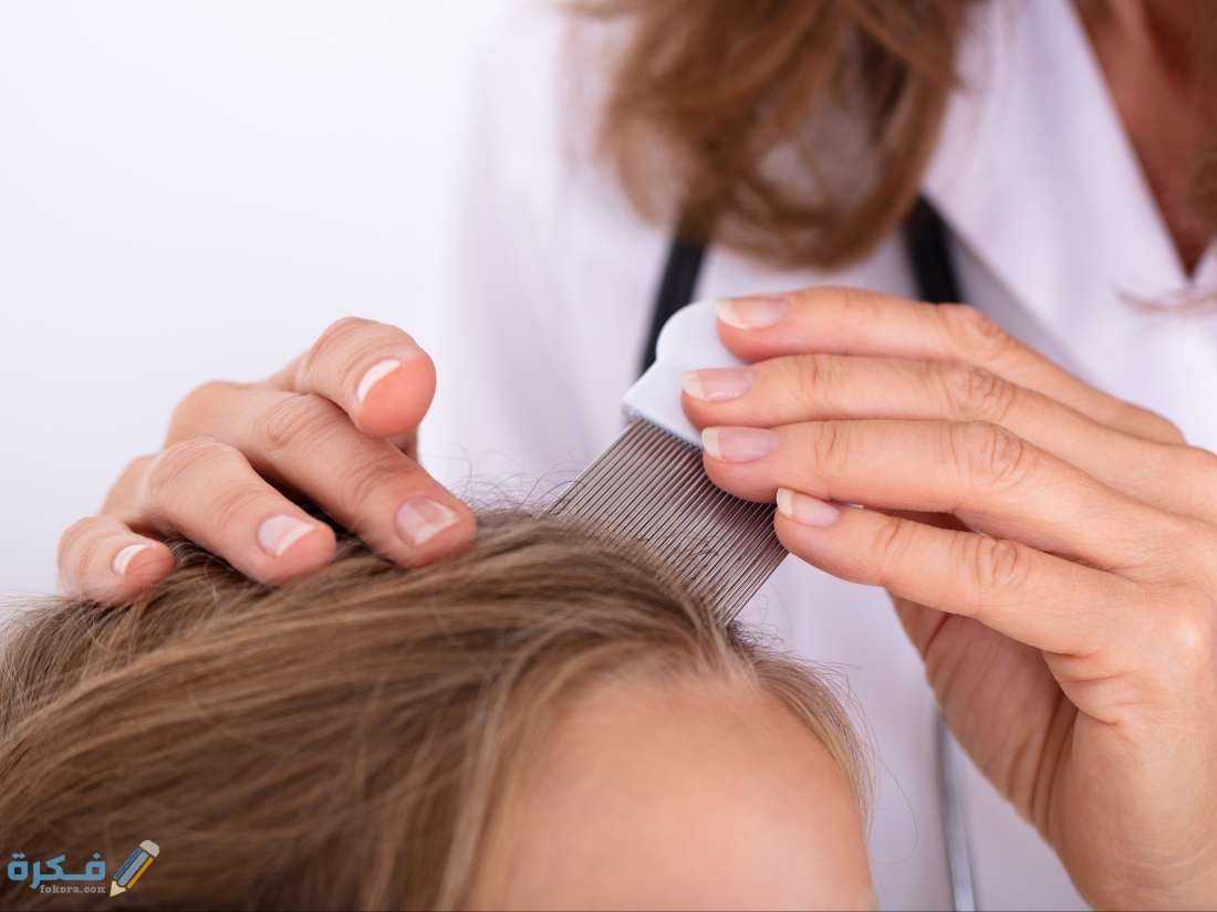 القمل في المنام على ماذا يدل 1 إزالة القمل من شعر الأطفال