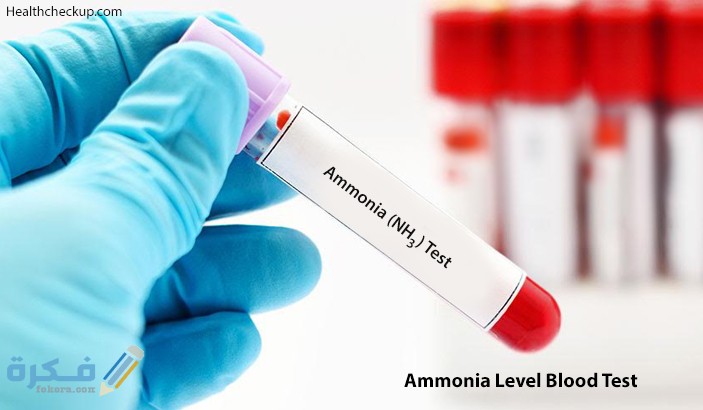 تحليل مستويات الأمونيا – Ammonia Levels Test 1 Ammonia Level Blood Test