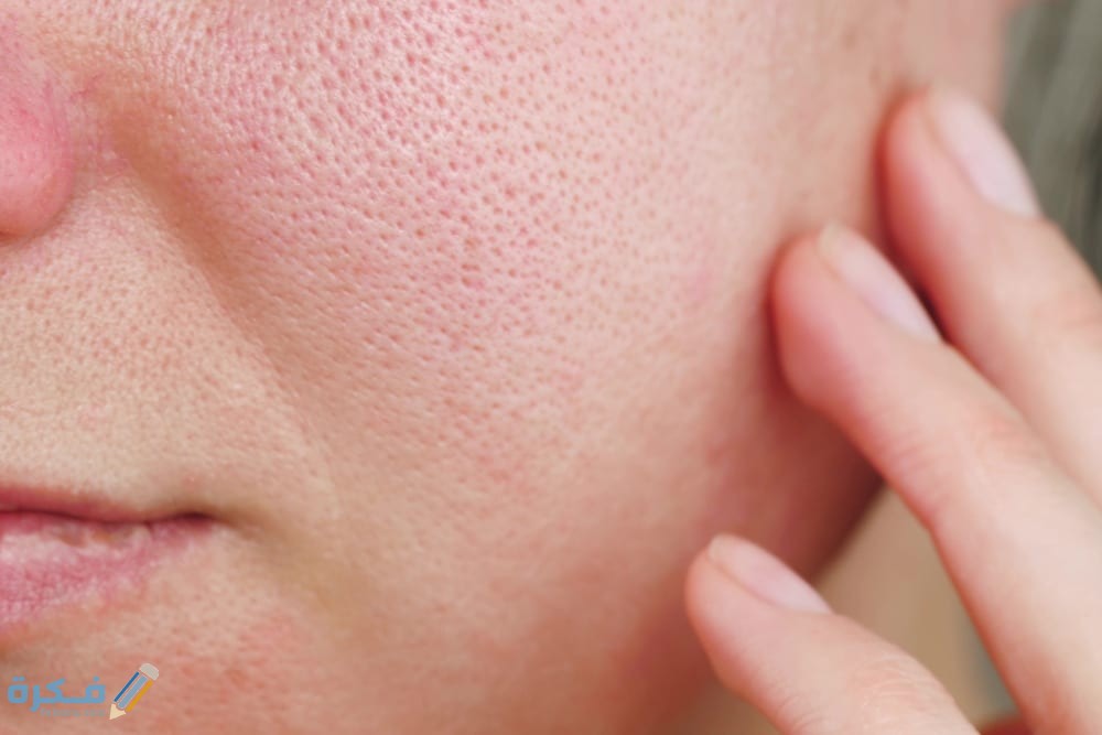 خلطات لتصغير المسامات الواسعة 1 Wellskin Blog Dec20