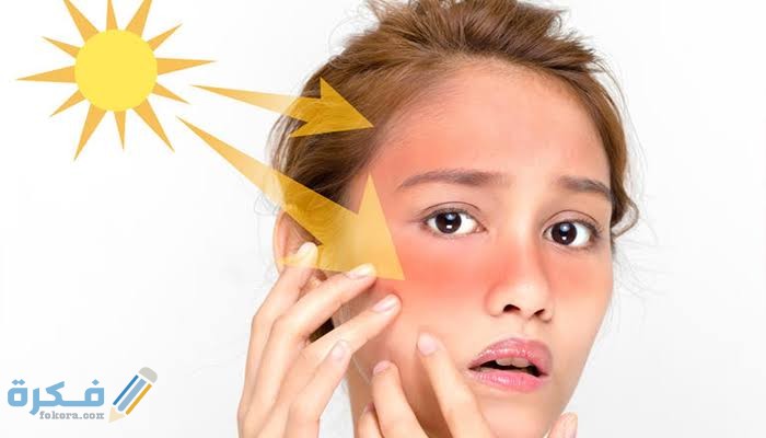 شرح خطوات التخلص من ضربة الشمس بسهولة 1 images 2021 11 27T231656.853