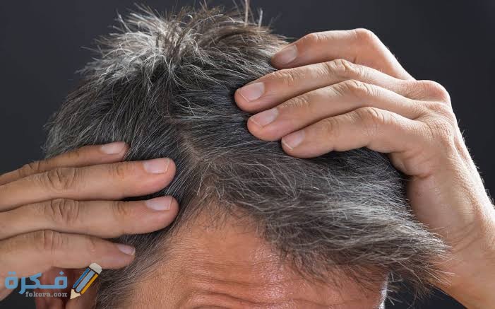 ما هي طرق علاج الشعر الأبيض المبكر