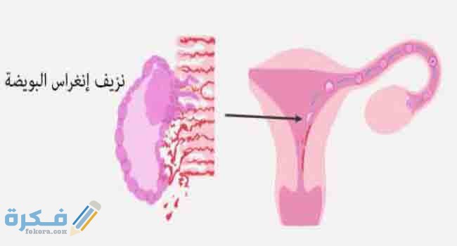 متى يظهر الحمل بعد انغراس البويضة داخل الرحم؟