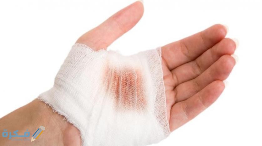 تفسير رؤية يد مقطوعة في المنام 1 injuries 09112017 100