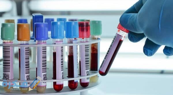 ما معنى PCT في تحليل الدم