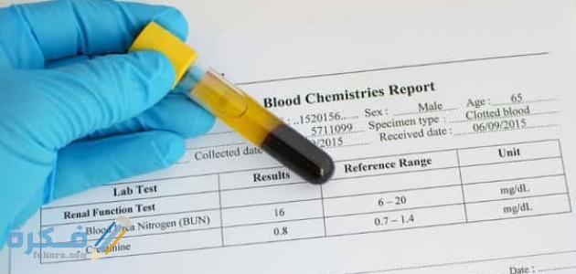 ما هي النسبة الطبيعية للكرياتين في الدم