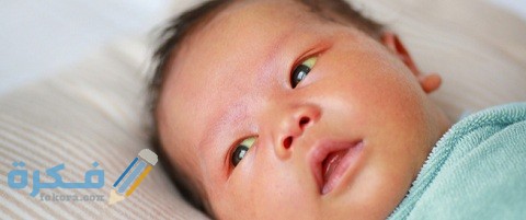 أسباب ضمور العصب البصري عند الرضع