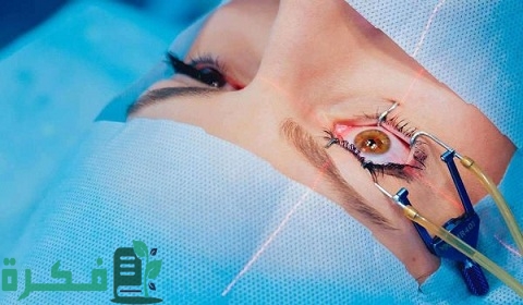 متى يستقر النظر بعد عملية الليزر السطحي 1 متى يستقر النظر بعد عملية الليزر السطحي