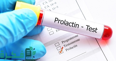 ما هو تحليل Prolactin للرجال - موقع فكرة