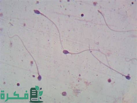ما المقصود بتحليل spermogramme et spermoculture بالعربية