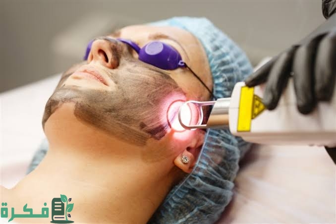 تجربتي مع تقشير الوجه بالليزر 1 images 2022 11 21T222235.199