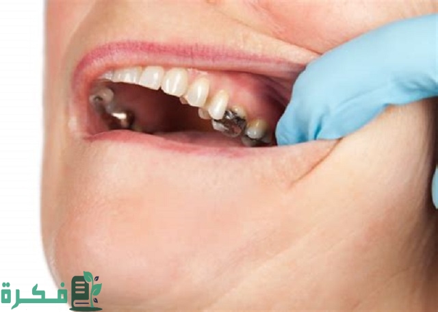 كيف تفرق بين ألم تسوس الأسنان والتهاب اللثة؟