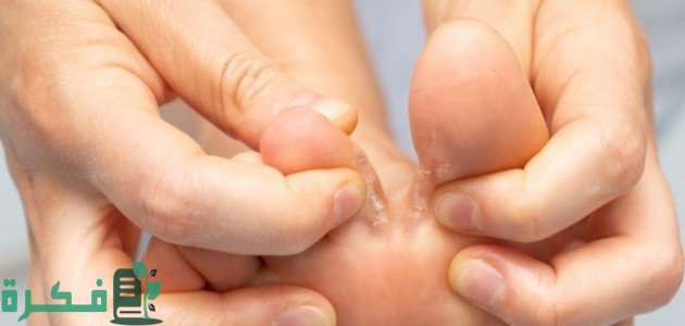 أفضل 5 أنواع كريم لعلاج فطريات أصابع القدم