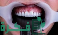 كم سعر ابتسامة هوليود في مصر