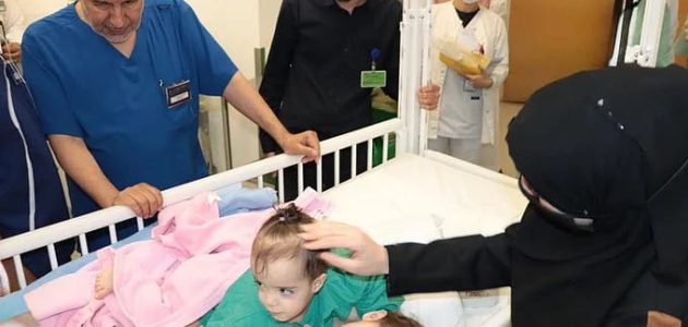 بدء عملية فصل التوأم السيامي السوري "سيلين وإيلين" في مستشفى عبد الله التخصصي تستغرق 9 ساعات 1 بدء عملية فصل التوأم السيامي السوري "سيلين وإيلين" في مستشفى عبد الله التخصصي تستغرق 9 ساعات