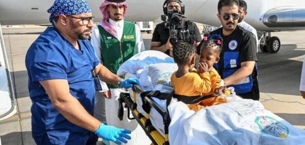 توأم جامايكي ملتصق يصلان إلى الرياض في حدث تاريخي 1 توأم جامايكي ملتصق يصلان إلى الرياض في حدث تاريخي